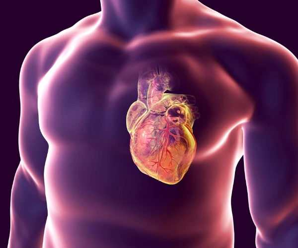 arrêt_cardiaque_causé_par_le_tabagisme